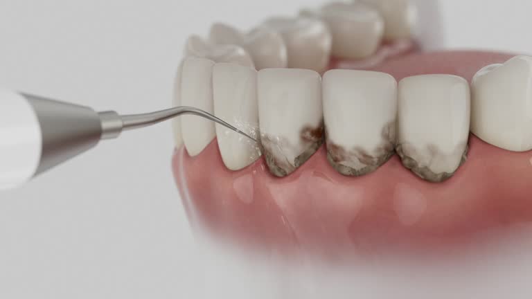 Reliable Invisalign Clear Aligners contractor in Mount Shasta, CA by Smile Center Dentistry